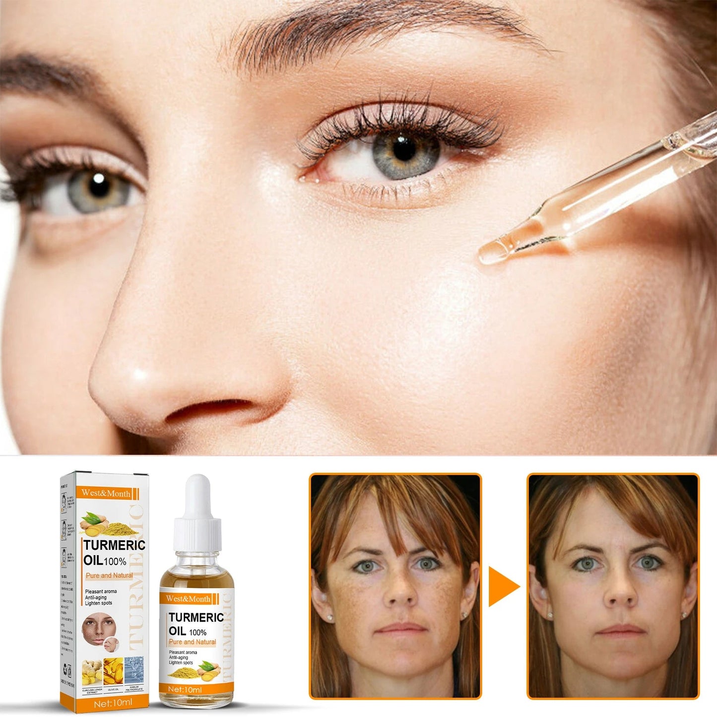 1+1 GRATIS - Ser pentru Pete Pigmentare, Riduri & Acnee - Turmeric si Curcumina, 30ml